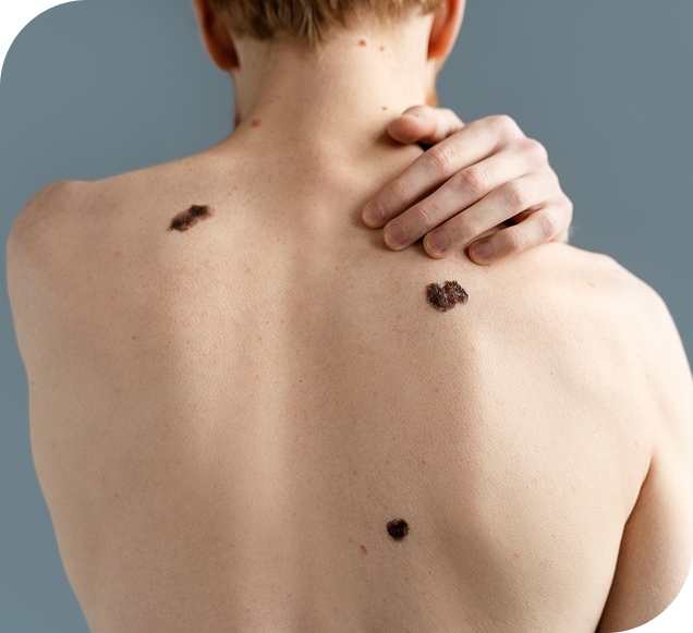 Early Detection In The Clinic