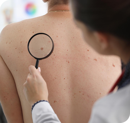 Doctor examining skin